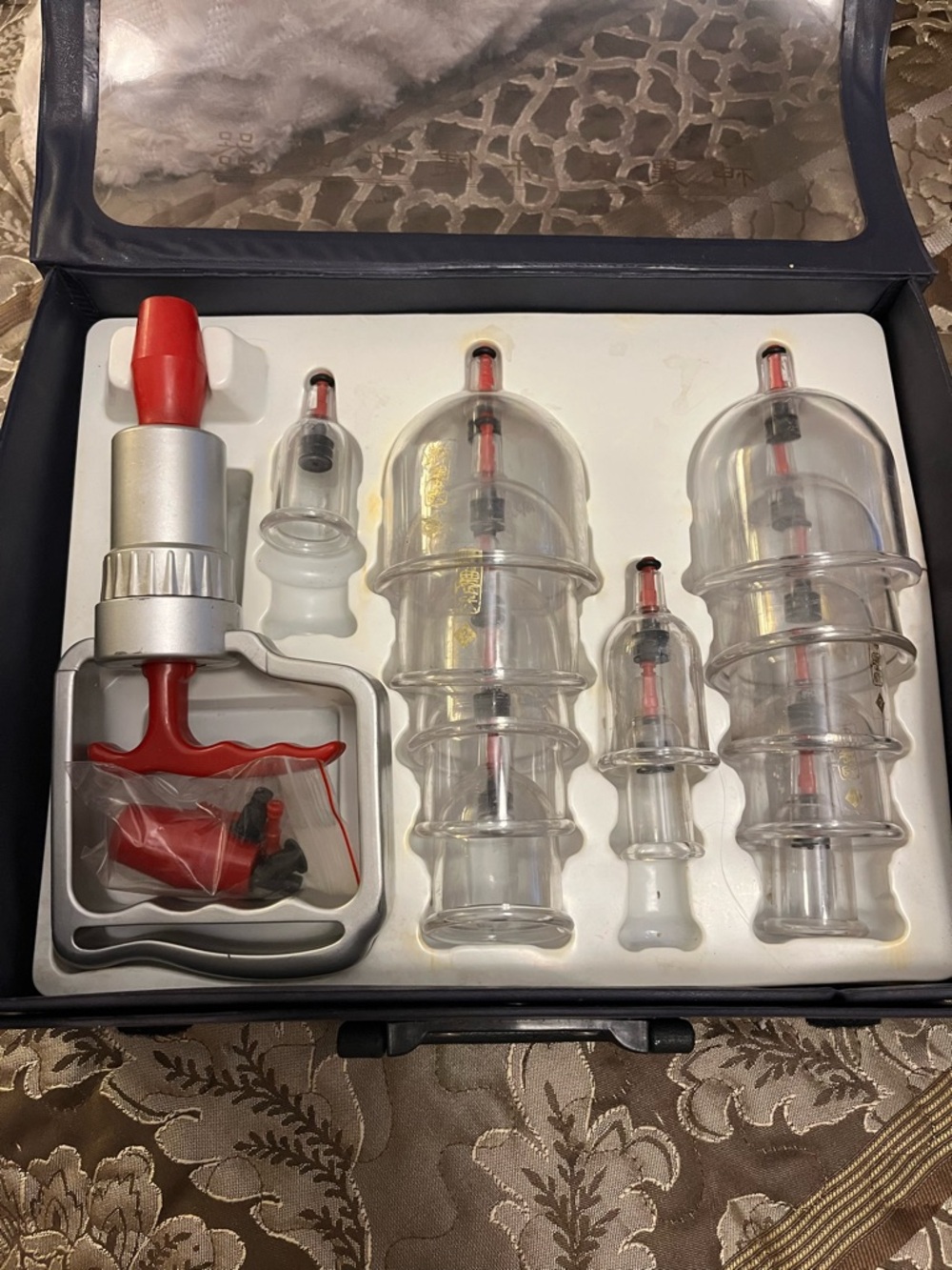 Retro Set of clear Cupping therapy Suction Cups with Red Accents (incomplete)
